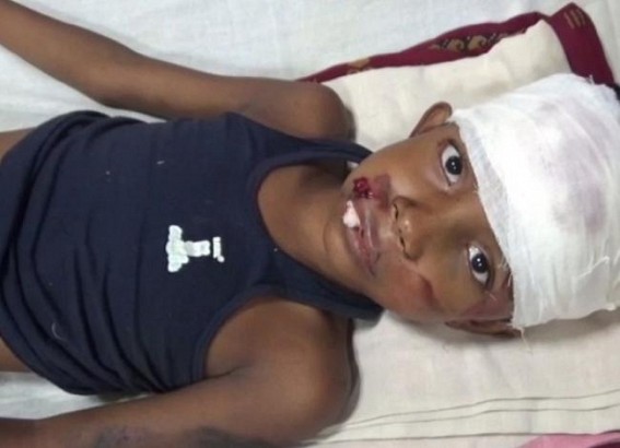 9-year-old in a critical condition after being hit by train 9-year-old in a critical condition after being hit by train
